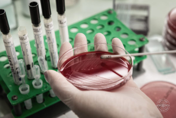 L’istologia studia la morfologia dei tessuti, e lecellule che li compongono, sia da un punto divista morfologico che funzionale. Lo strumentoessenziale per l’istologia è il microscopio ottico,che permette l’osservazione diretta dei tessuti chesi vogliono studiare. L’analisi istologica permettel’individuazione di neoplasie e la conseguentediagnosi. I campioni vengono lavorati e trattatiin vari modi, devono essere tagliati in striscesottilissime per permetterne l’osservazione incontroluce, possono essere colorati in vari modiper facilitarne il riconoscimento e la distinzionee vengono trattati in modo da prevenirne ladecomposizione per permetterne la conservazioneper analisi successive.